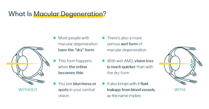 What is Macular Degeneration